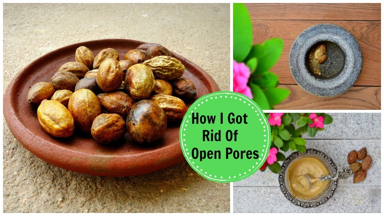 How I Got Rid Of Large OPEN PORES Permanently & Naturally Using an Ayurvedic Remedy!