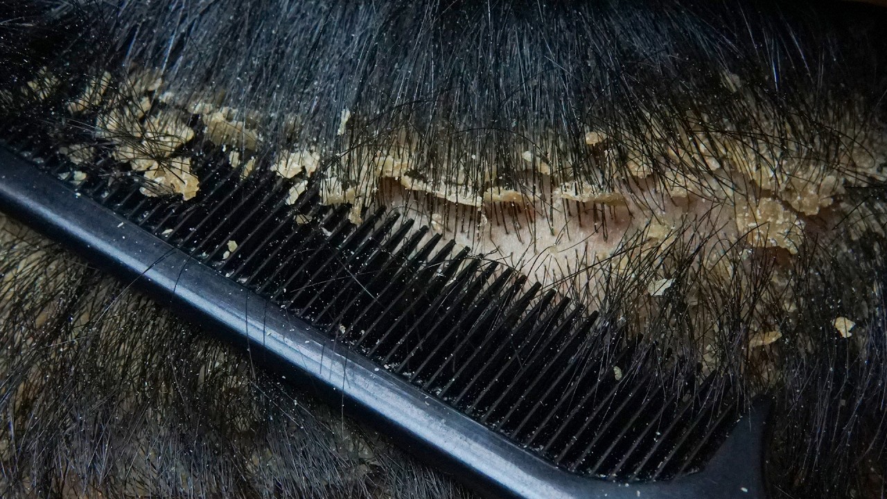 ASMR Super Comfortable Scalp Care #DKMO3772