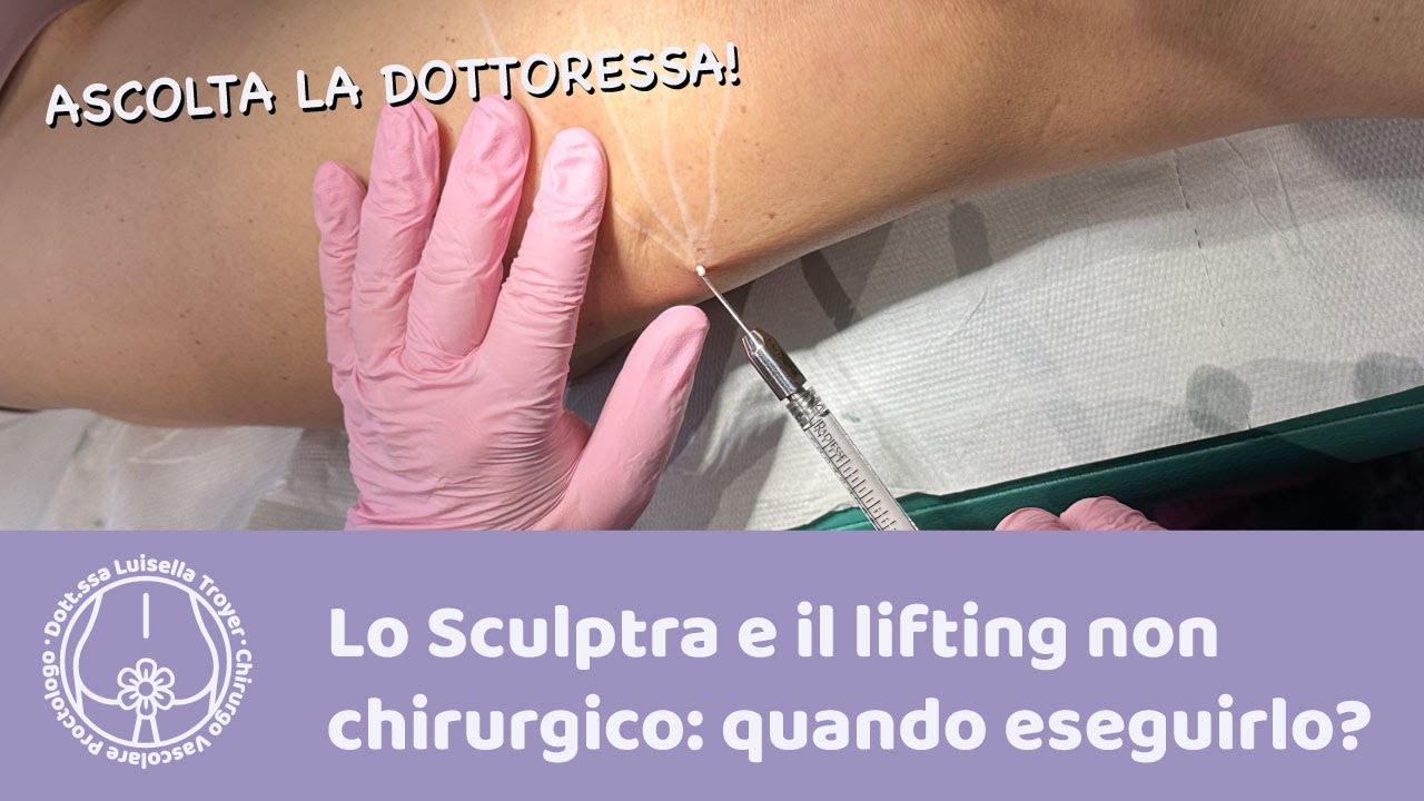 Lo Sculptra e il lifting non chirurgico: funziona davvero?