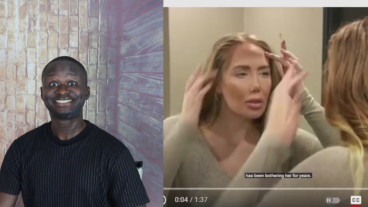 She Wants To Make Her Forehead Vanish