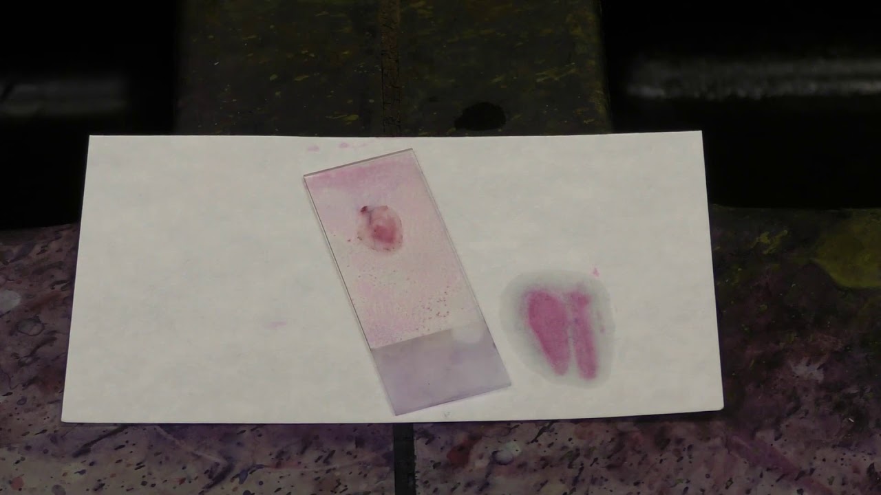 Gram stain interpretation