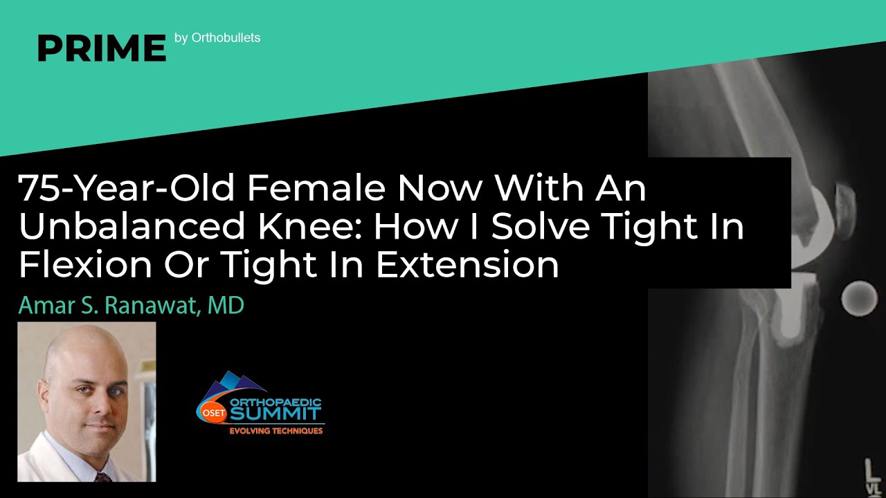 75F Now W/ An Unbalanced Knee: How I Solve Tight In Flexion Or Tight In Extension - Amar Ranawat, MD