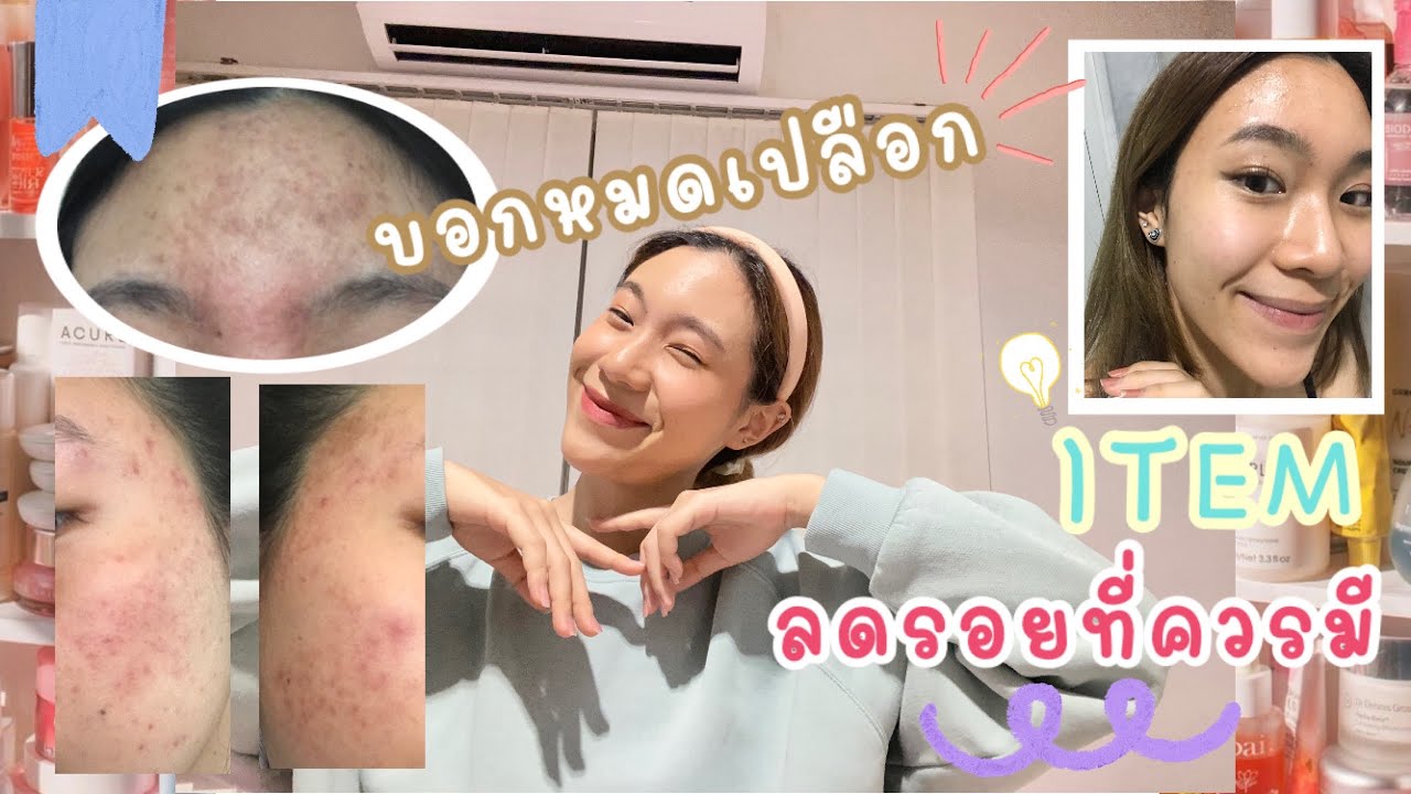 รวมสกินแคร์รักษารอยสิว ใช้แล้วเห็นผล!! รอยดำรอยแดงก็เอาอยู่ (คัดมาแล้วจุกๆ) | rrommanee