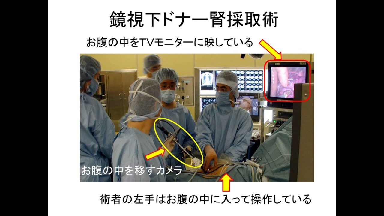 Yagoto RedCross News(腎移植啓発)【名古屋第二赤十字病院　腎移植】生体腎移植術とドナー腎採取術no2