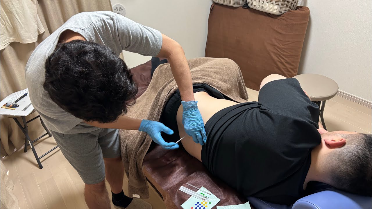 側臥位大腰筋刺鍼