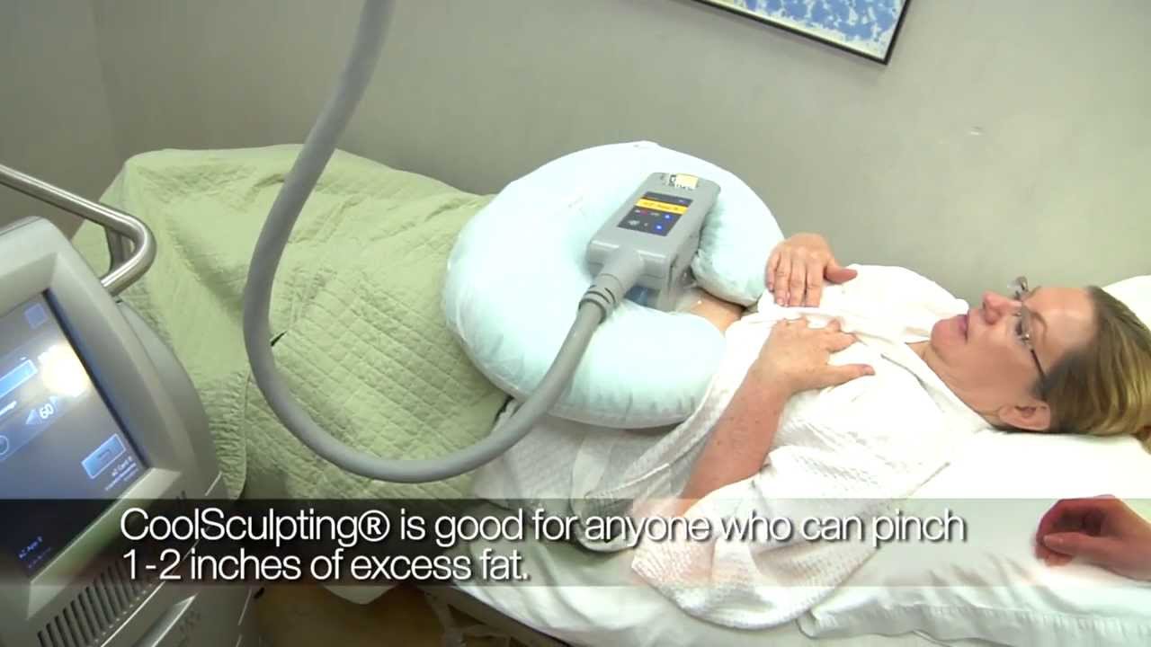 Coolsculpting by ZELTIQ