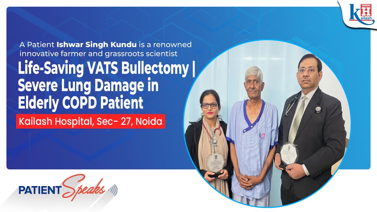 Severe Breathlessness Treated with VATS Bullectomy | Patient Success Story – Kailash Hospital Noida