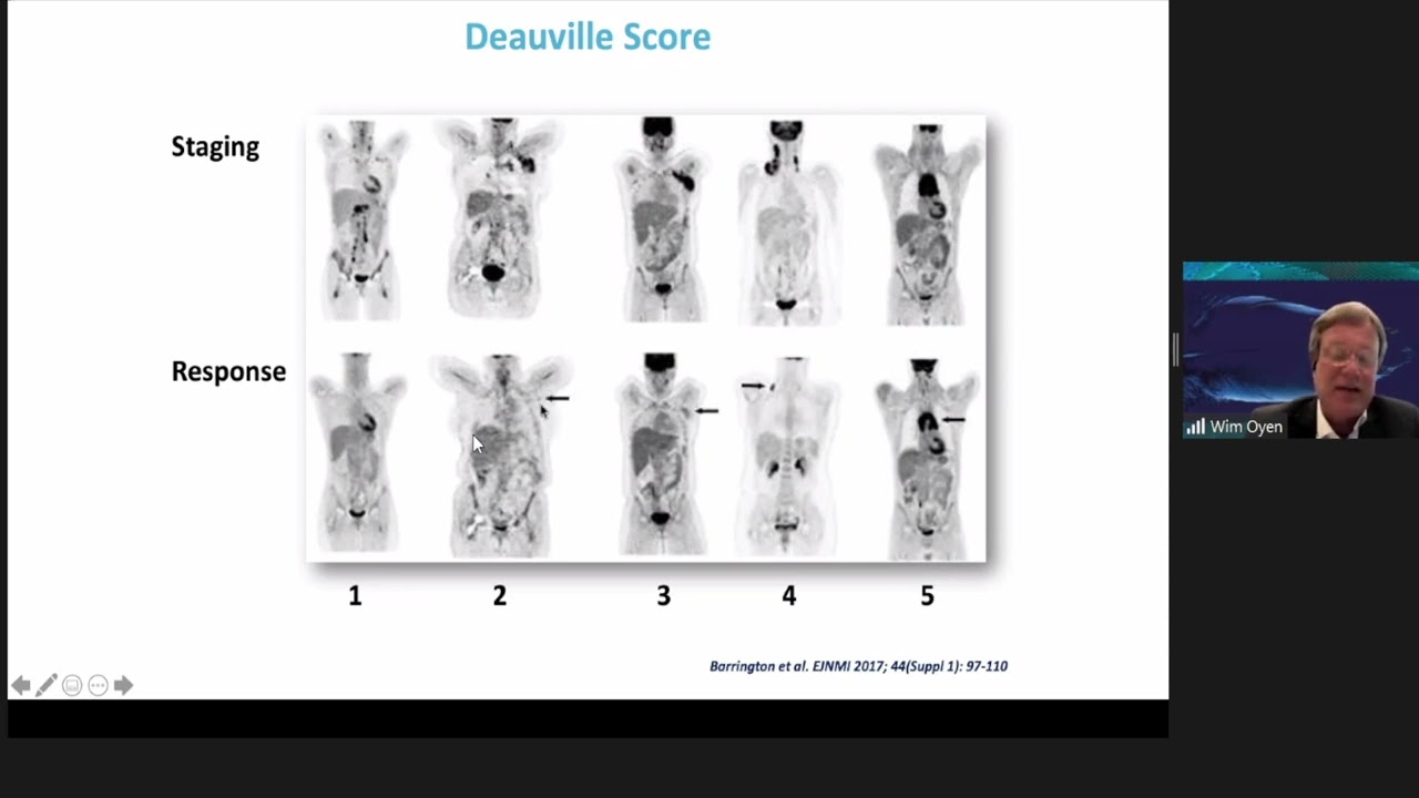 'Response assessment in lymphoma' by Prof. Wim Oyen, delivered at ICIS 2021