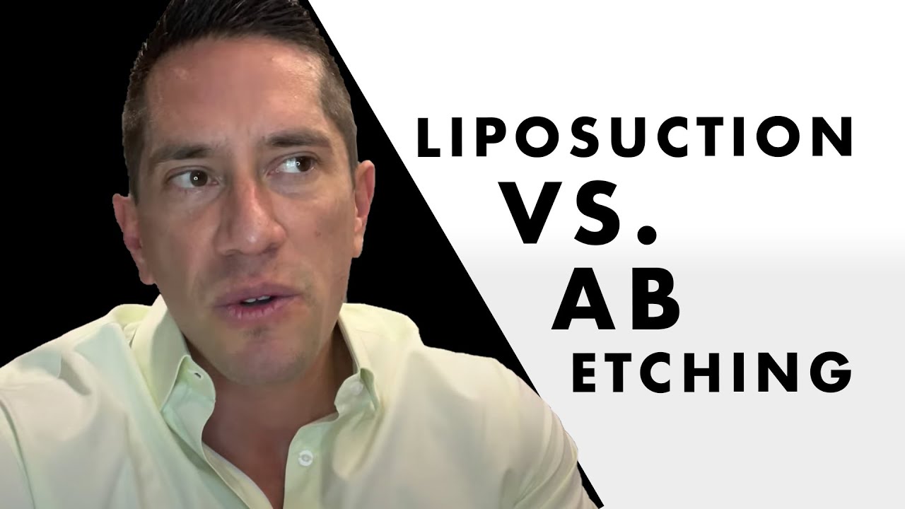 How is Liposuction different than Ab etching