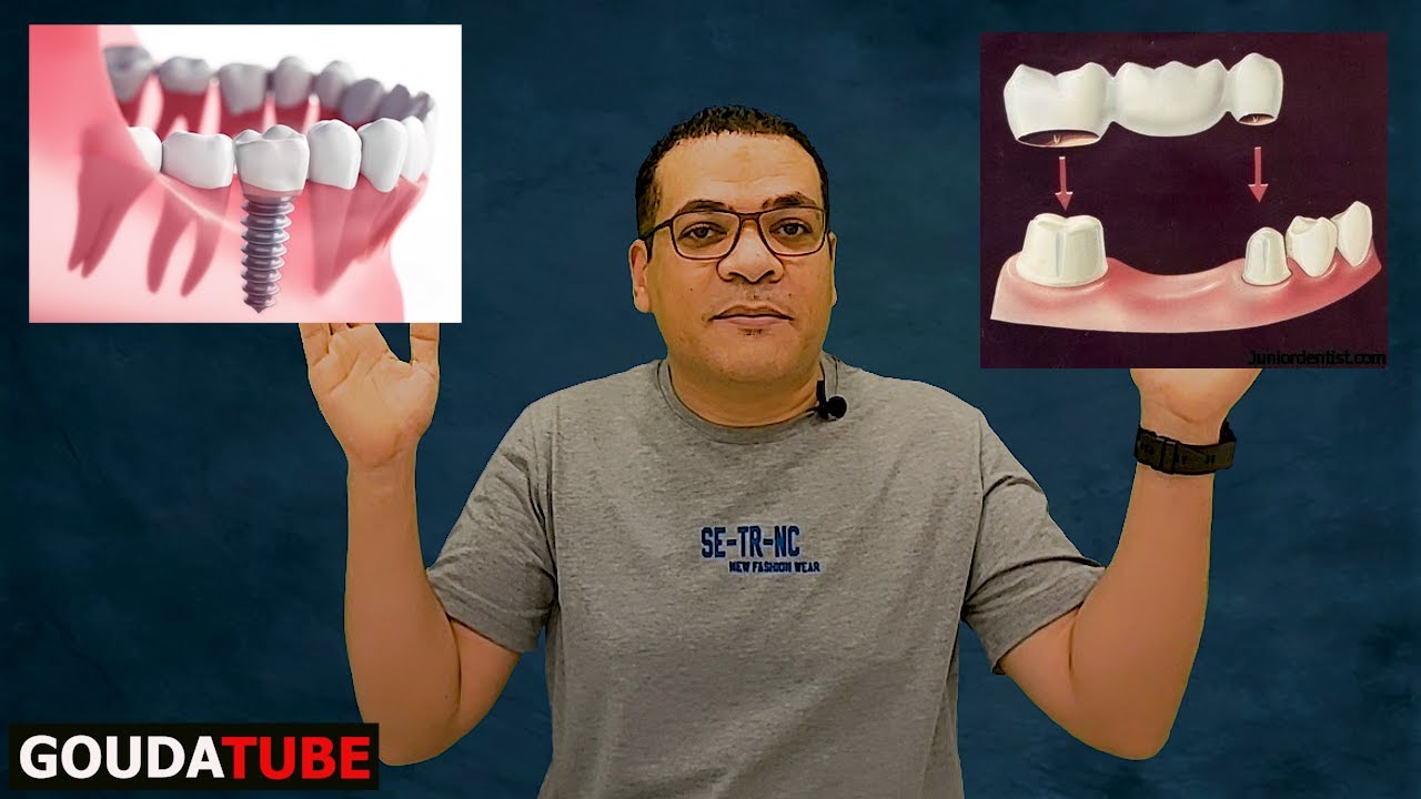 بعد الخلع ازرع والا اعمل تركيبة ؟؟؟