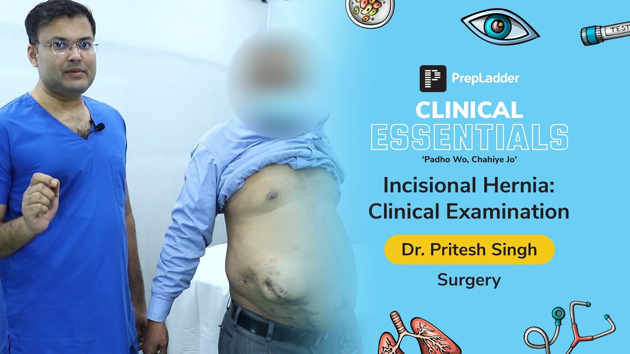 PrepLadder Clinical Essentials | Incisional Hernia: Clinical Examination | Dr. Pritesh Singh
