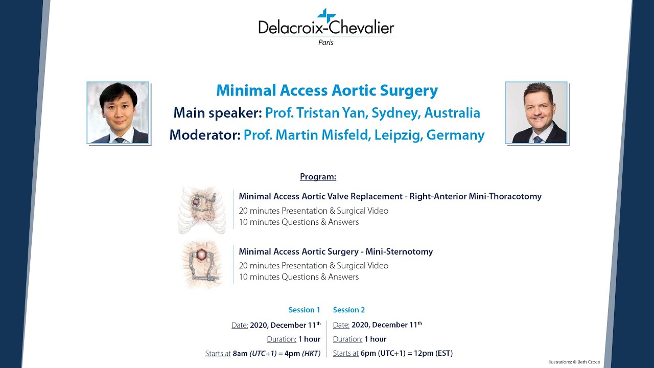 Prof. Yan, Prof. Misfeld - Minimal Access Aortic Surgery by Delacroix-Chevalier