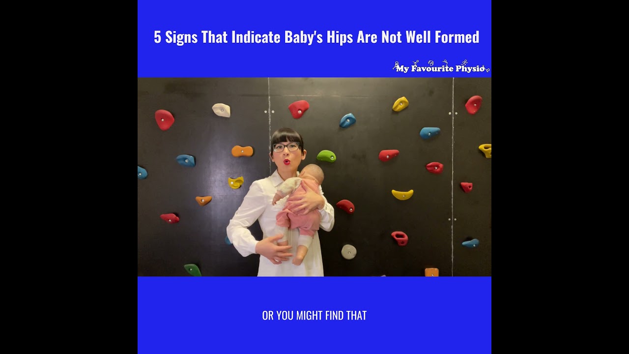🔥🔥🔥5 Signs That Indicate That Baby&rsquo;s 👶🏻 Hips Are Not Well Formed
