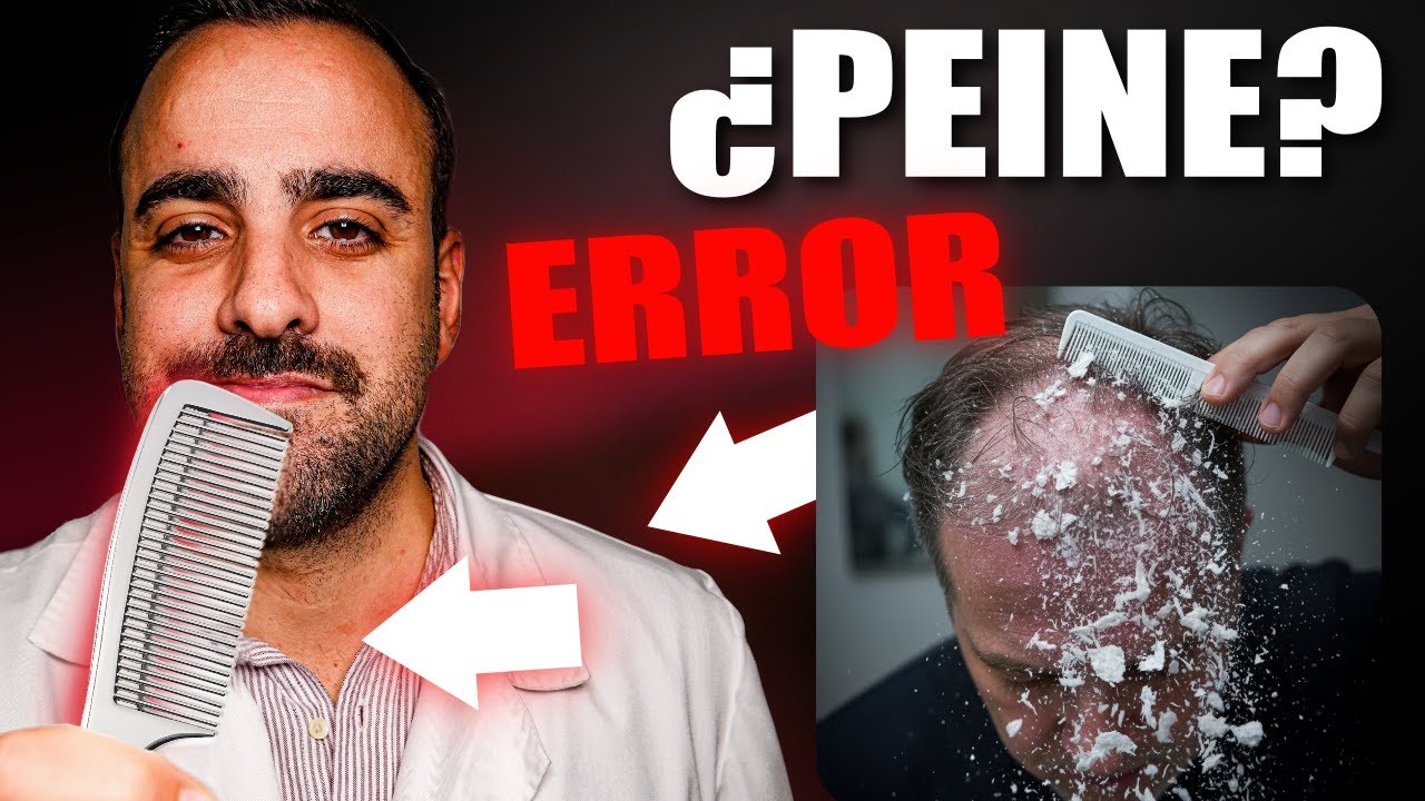 Psoriasis en la Cuero Cabelludo: Lo que nadie te dice (y cómo evitar empeorarla)