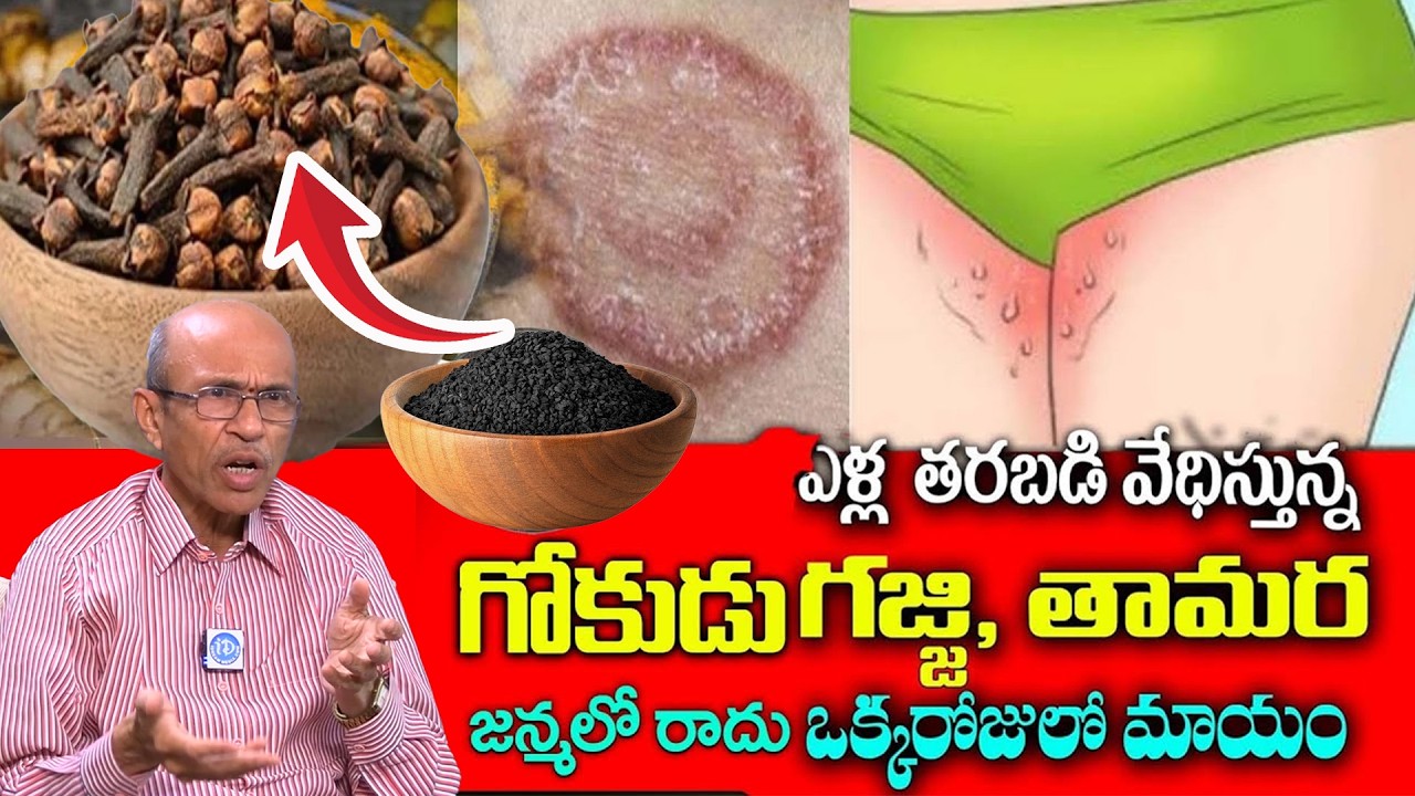 ఎంతటి మొండి తామర అయినా ఇది రాస్తే చాలు || How to Remove Ringworm Naturally | Dr Madhusudhana Sharma