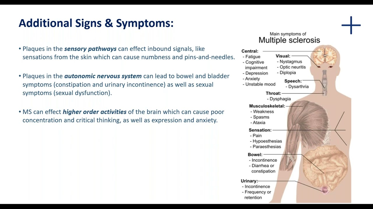 Cord Blood Stem Cells in the treatment of Multiple Sclerosis (31st March 2021)