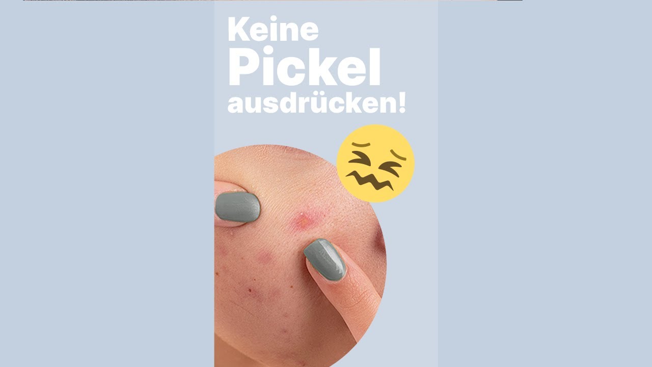 Warum Du keine Pickel ausdr&uuml;cken solltest! │Dr. med. Alice Martin #shorts