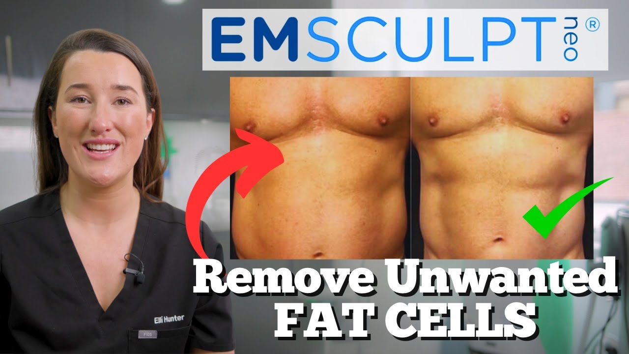 Emsculpt Neo | Насколько эффективен контурный массаж тела? | Специалист по уходу за кожей Элли об...
