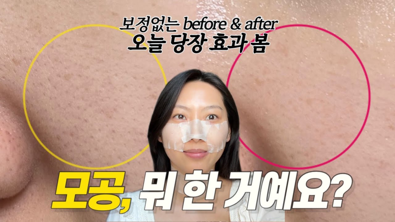 7년차 홈케어 전문가가 알려주는 모공 줄이는 법💁‍♀️  10분만에 깐달걀되는 꿀팁 대방출