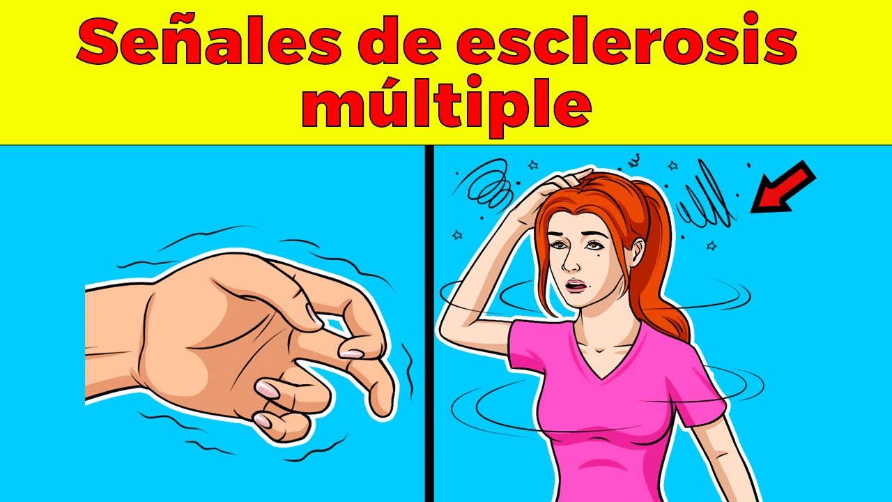 15 señales tempranas de Esclerosis Múltiple