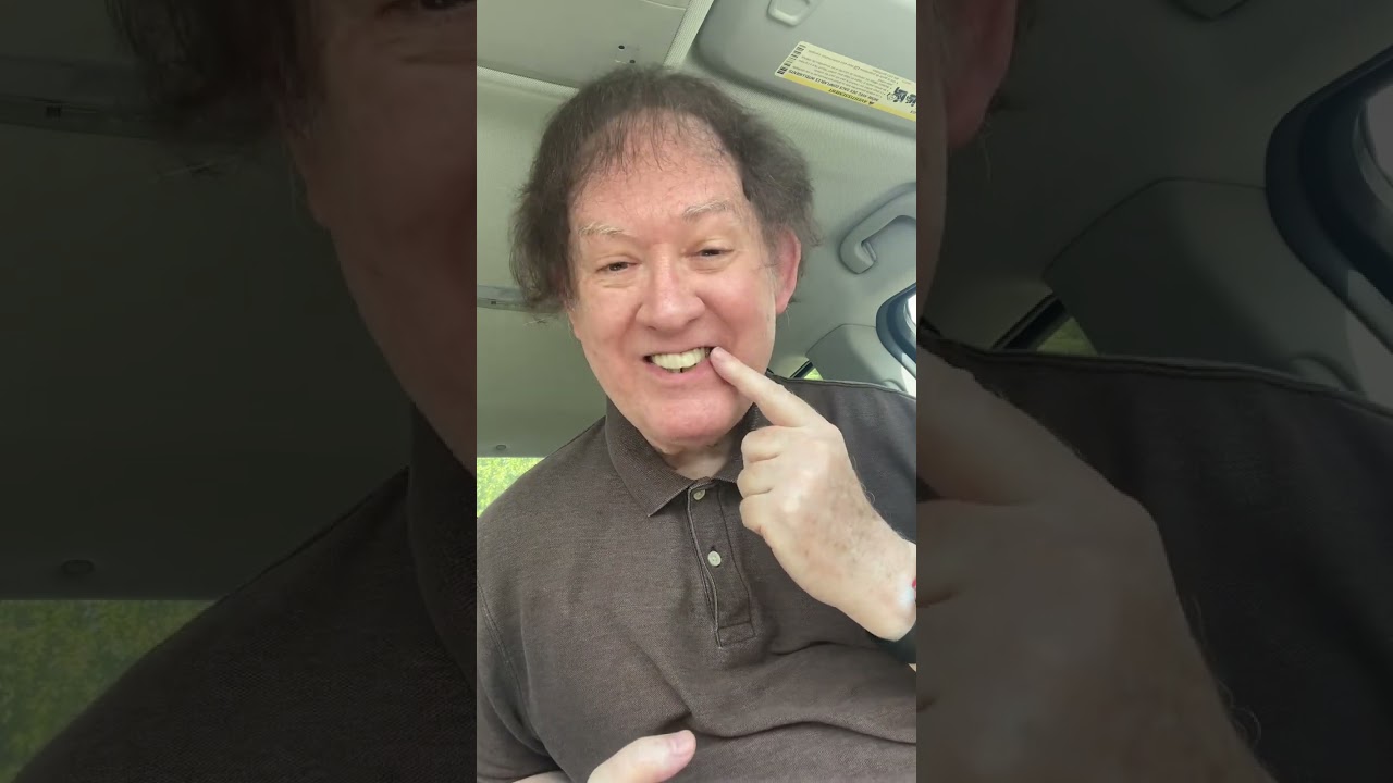 Pop On Veneer Review by David Mills