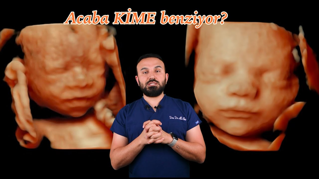 Detaylı Ultrason ile Yüz Fotoğrafları I Doç. Dr. Ali Ekiz
