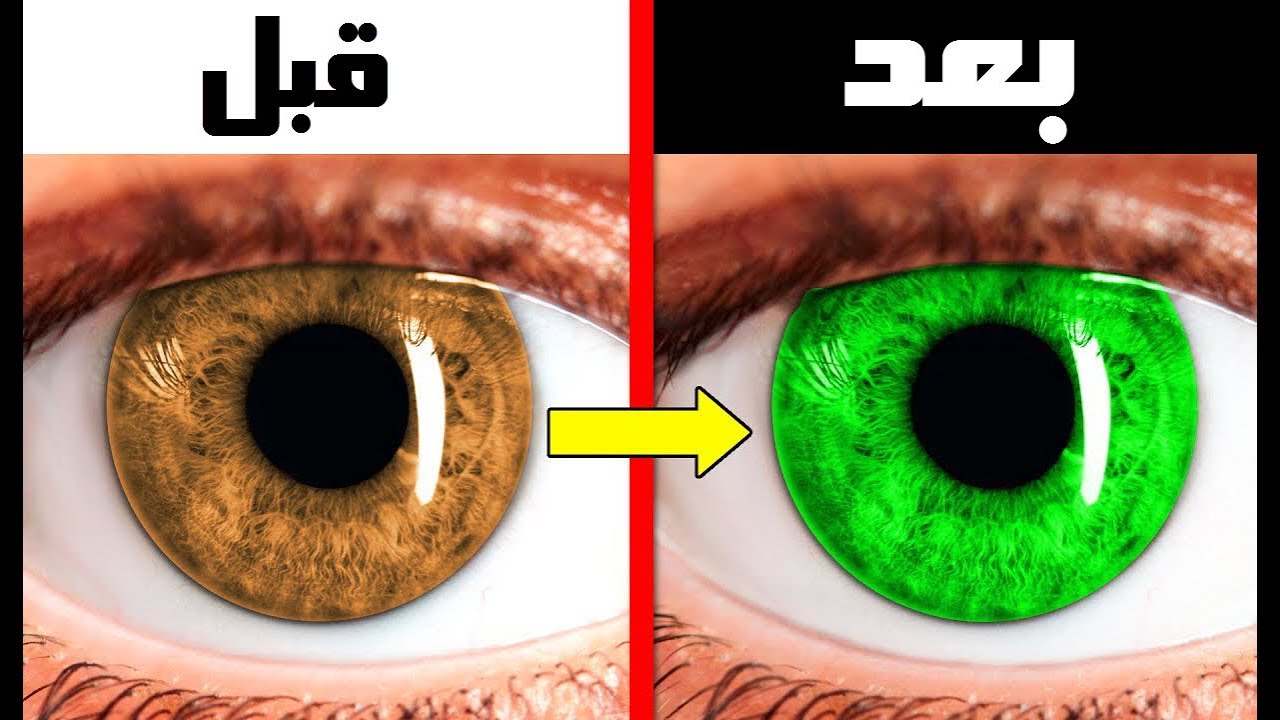 هل يمكن تغيير لون العين ..؟