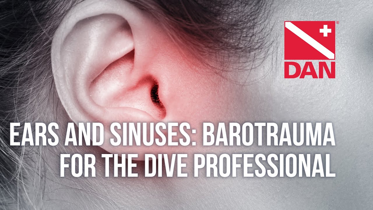 Ears and Sinuses: Barotrauma for the Dive Professional