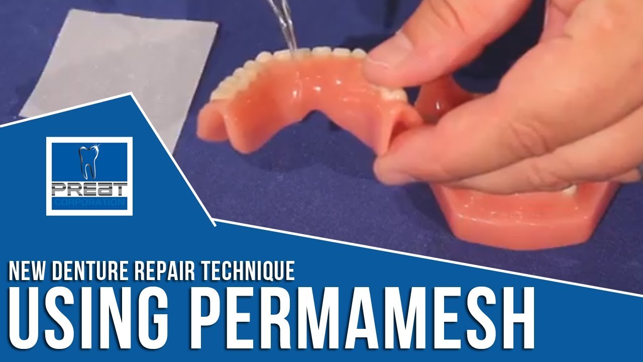 New Denture Repair Technique Using Perma Mesh By PREAT Corporation