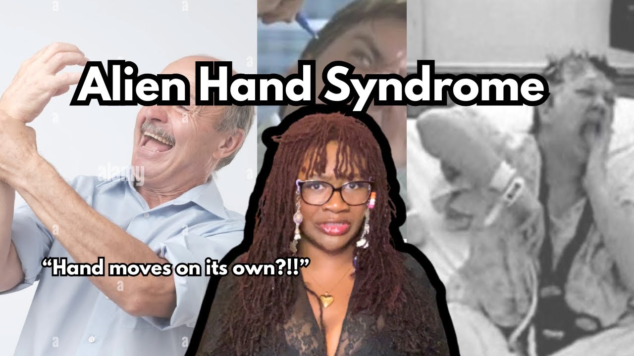 Alien Hand Syndrome Explained (Neuroscience) | AJTheScienceGay