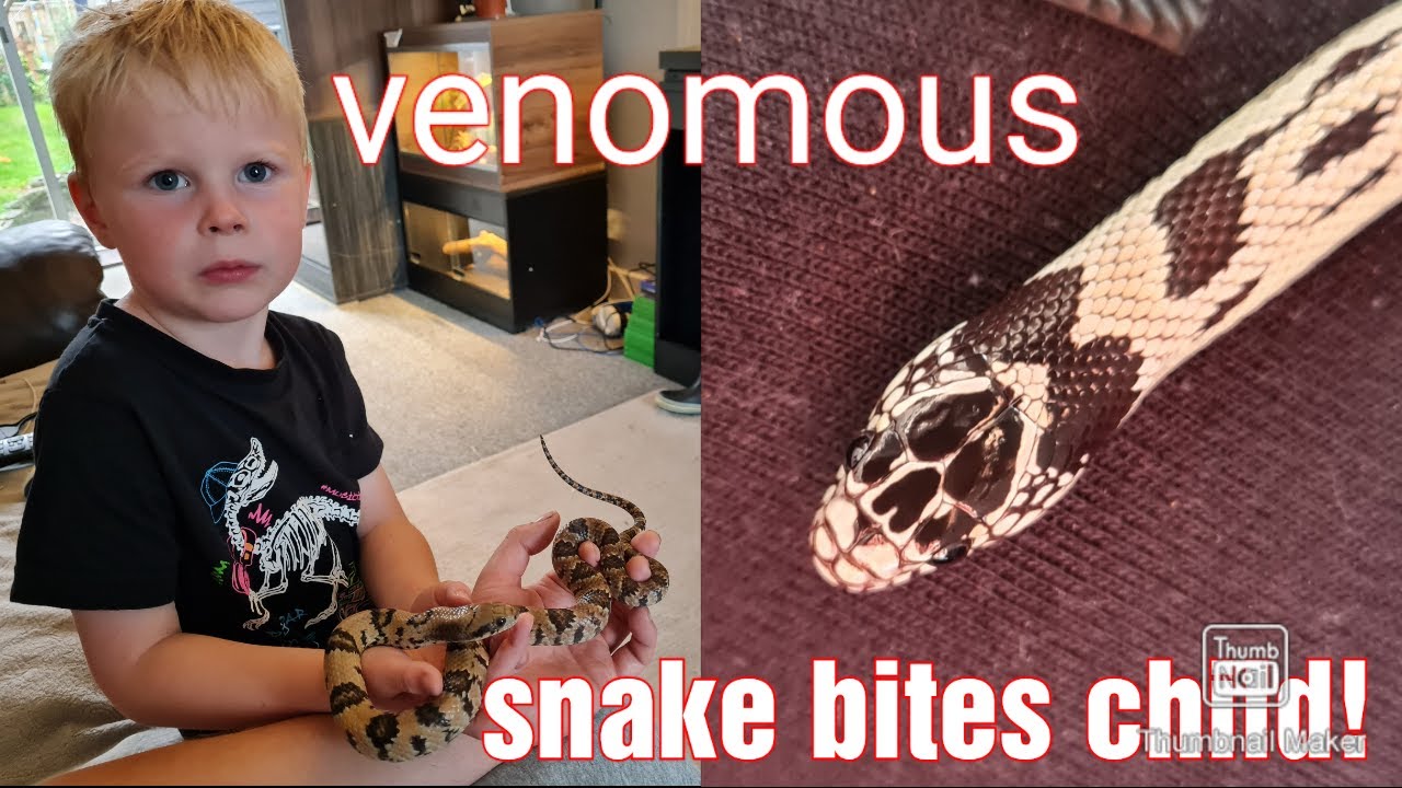 venomous snakes bites child!