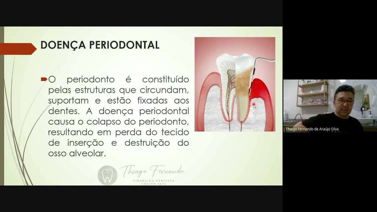 Resumo de Periodontia + Resolução de questões