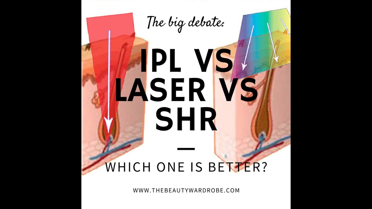 What is better, IPL, Laser or SHR? What is SHR Technology? How does it work?