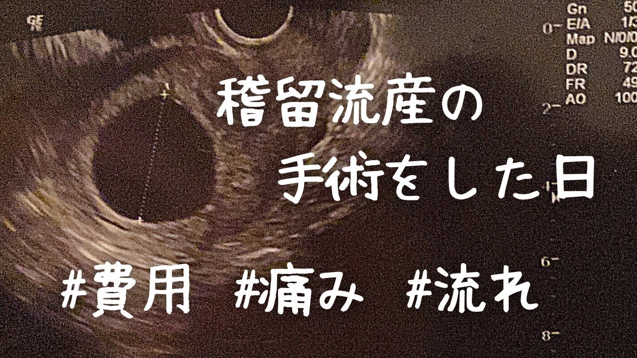 【稽留流産】手術の費用・痛み・流れ・保険について。（子宮内容除去手術）