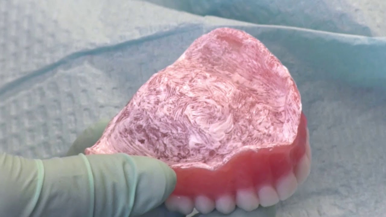DENTCA Impressions Step 6 - Final Delivery Appointment