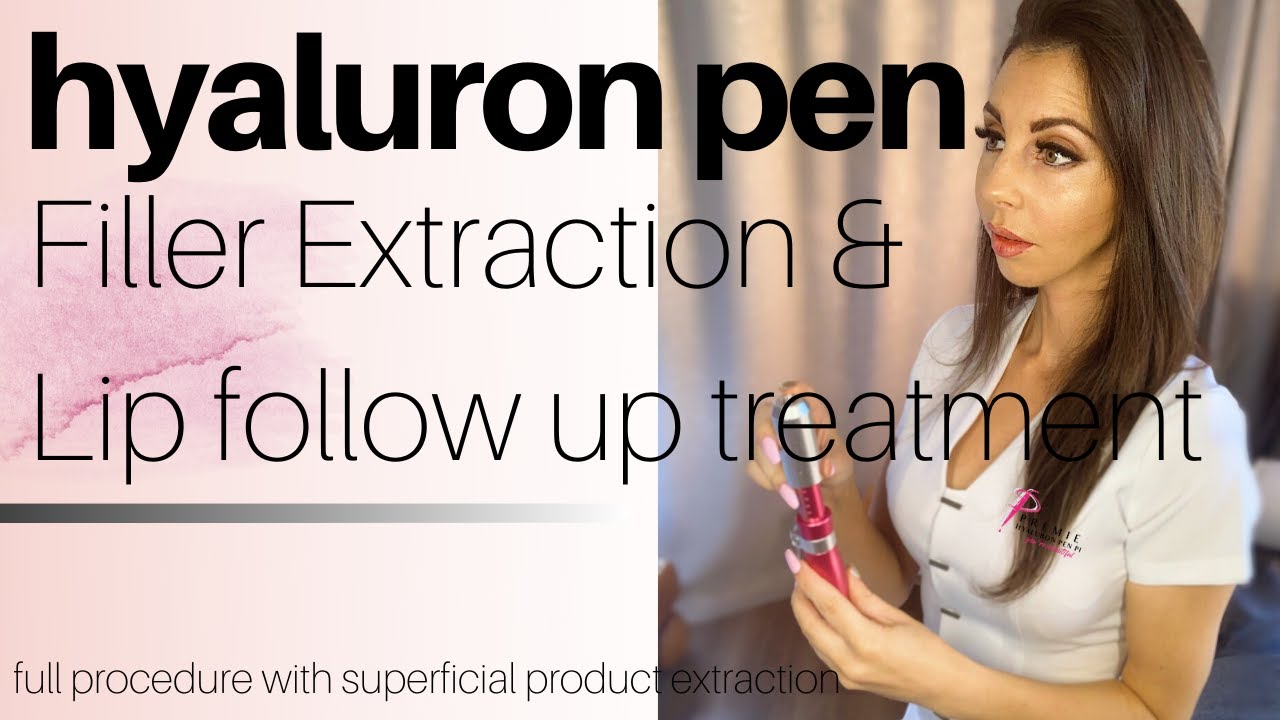 HYALURON PEN lip filler follow up procedure & extraction