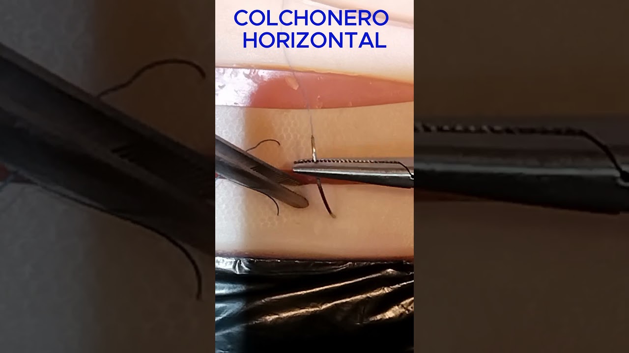 SUTURAS: COLCHONERO HORIZONTAL #shorts