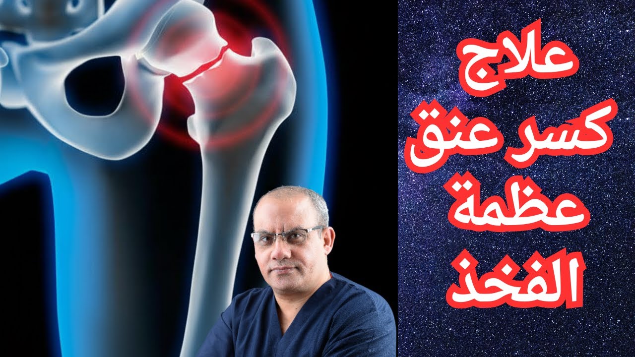 علاج كسر عنق عظمة الفخذ/كسور عنق عظمة الفخذ/كسور مفصل الفخذ