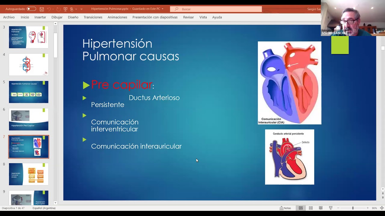 Hipertension Pulmonar El Enemigo Silencioso