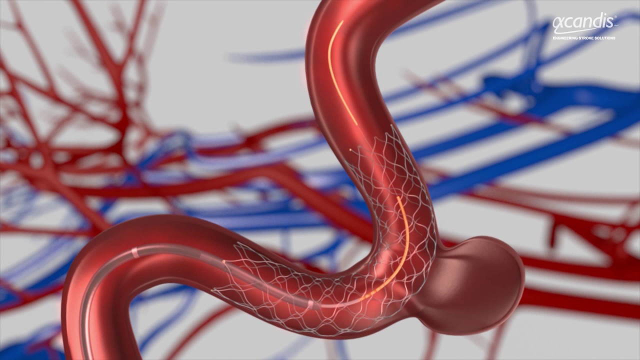 Product Animation Acclino® flex Stent