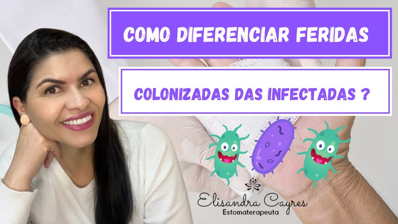 COMO DIFERENCIAR FERIDAS COLONIZADAS DAS INFECTADAS?