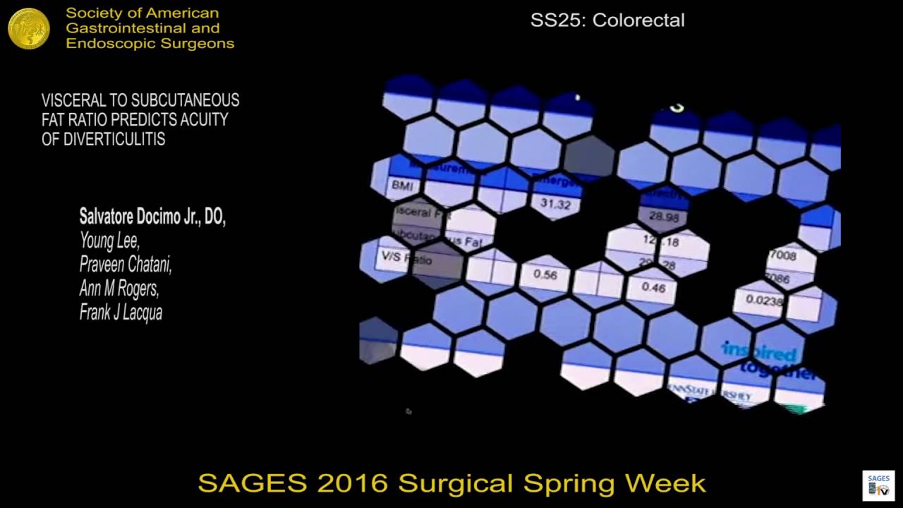 Соотношение висцерального и подкожного жира позволяет прогнозировать тяжесть дивертикулита.