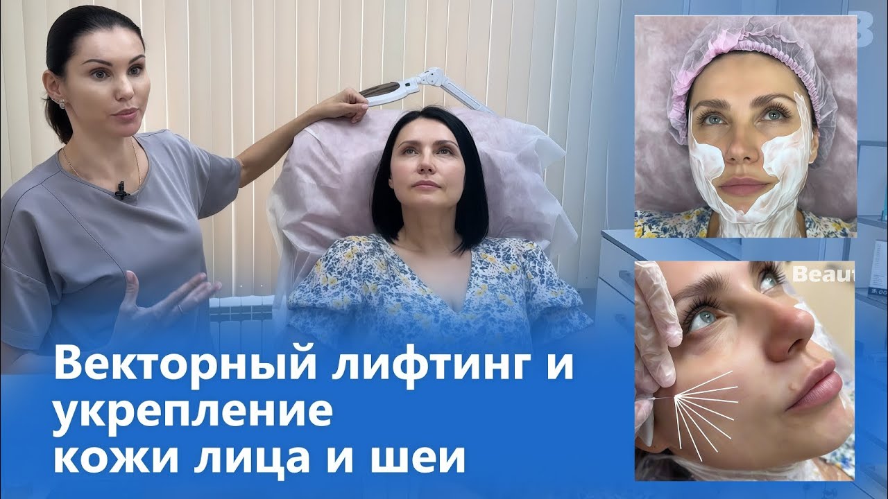 Векторный лифтинг и укрепление кожи лица и шеи препаратом Радиес