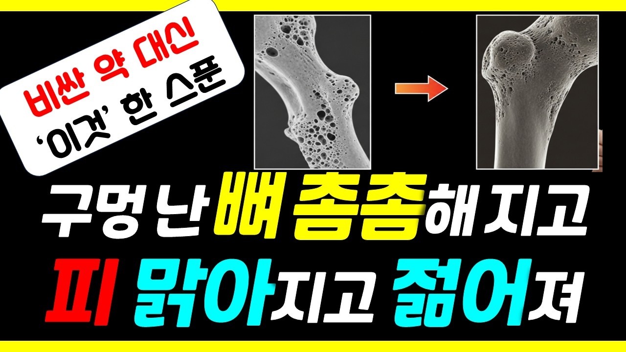 90세까지 골절 없는 사람들은 '칼슘' 대신 반드시 이 음식을 먹습니다ㅣ매일 약대신 '한스푼' 이면 뼈가 촘촘해집니다.