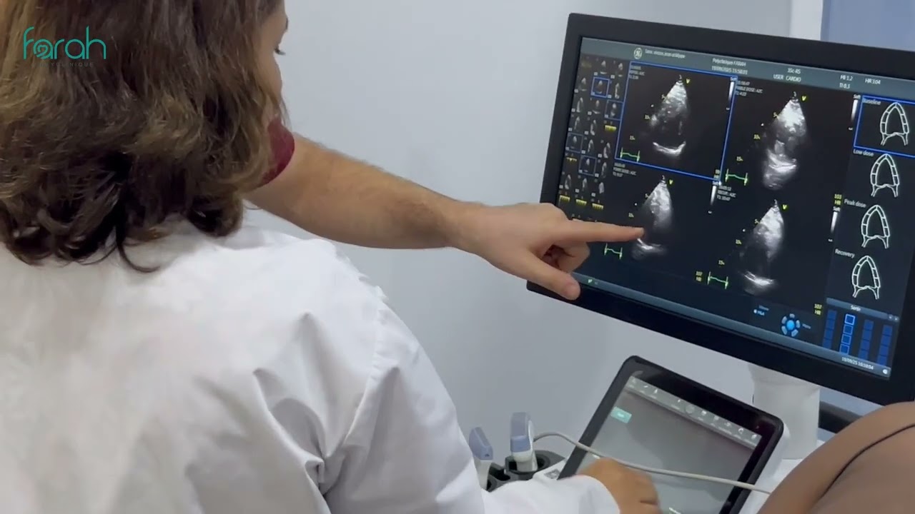 Échocardiographie de stress : une avancée majeure à la Polyclinique Farah