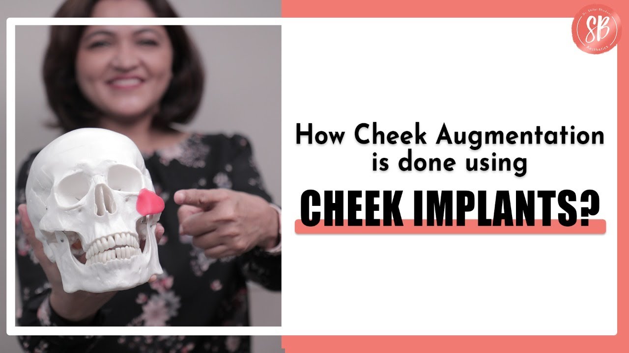 How is done Cheek Augmentation using Cheek Implants? | Cheekbone Surgry | Cheek Bone Adjustment