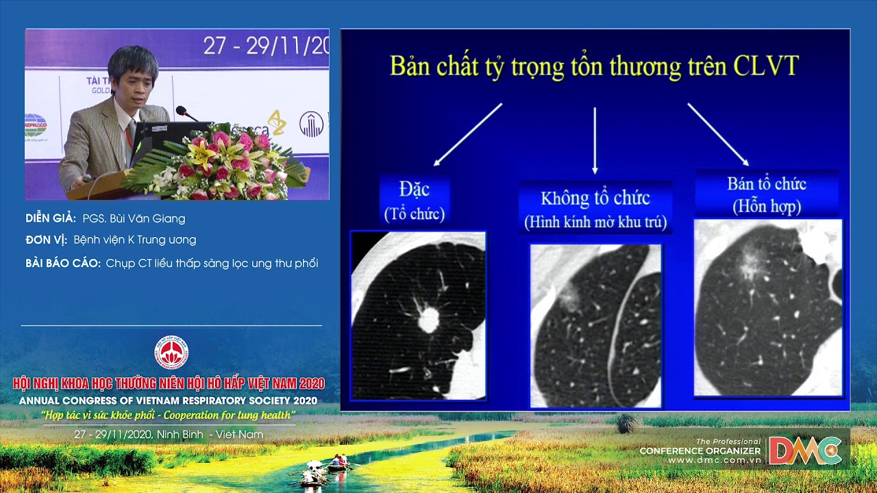 Chụp CT liều thấp sàng lọc ung thư phổi