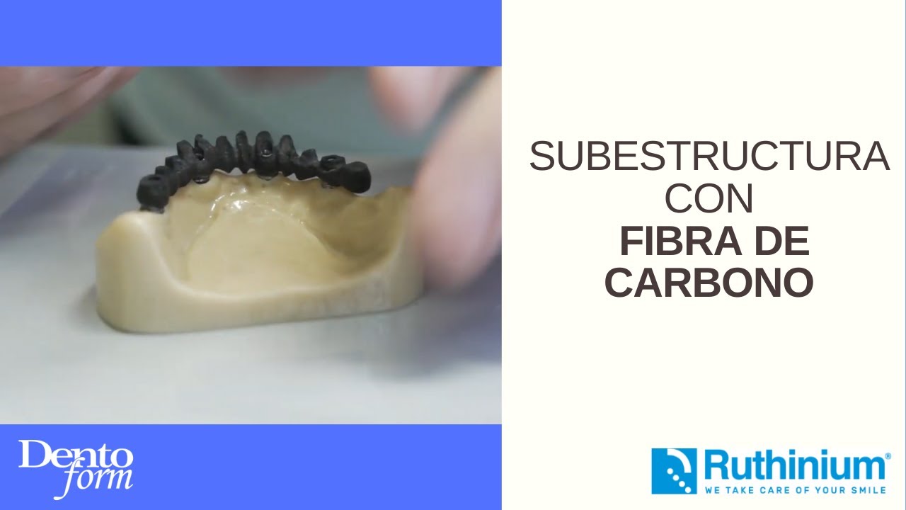Subestructura con Fibra de carbono