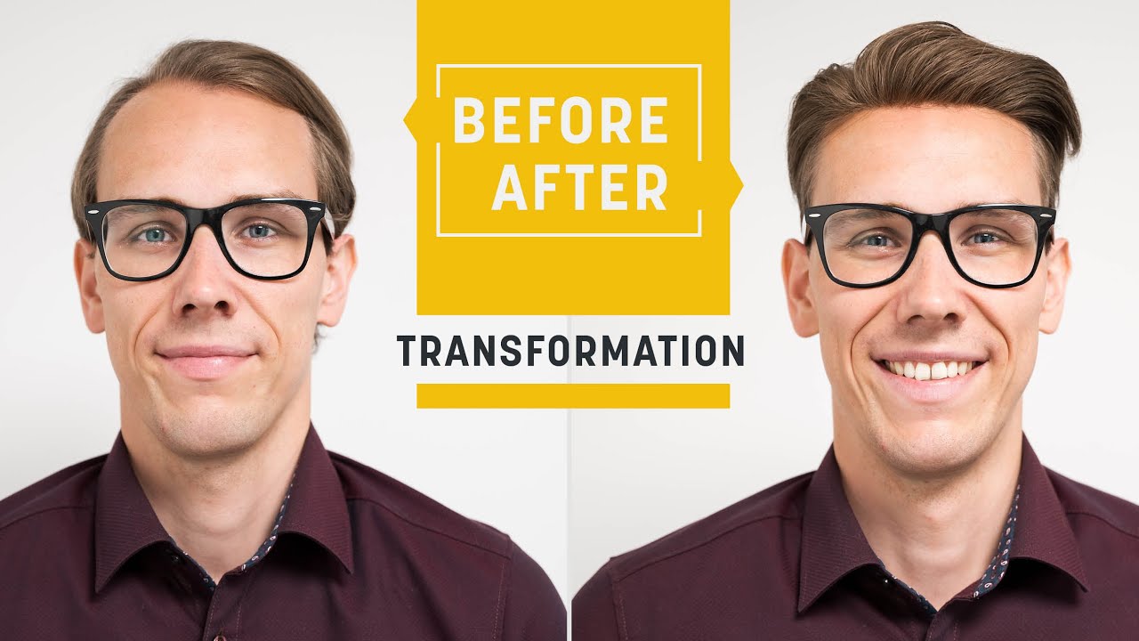 How to conceal receding hairlines perfectly | Hairsystem for the front | Hairsystems Heydecke