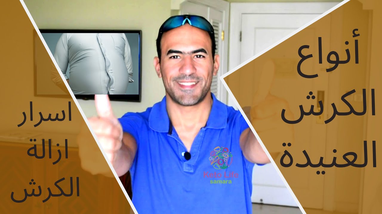 ازلة الكرش و دهونه البطن - انواع الكرش وحيل التخلص منه -2019